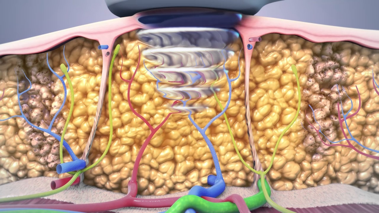 Ei explică modul în care țesutul adipos brun ajută la controlul tensiunii arteriale.