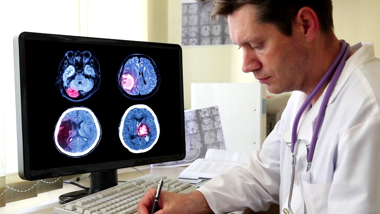 Ei dezvoltă un medicament împotriva unui tip agresiv de cancer cerebral, pentru care până în prezent nu exista un tratament eficient.