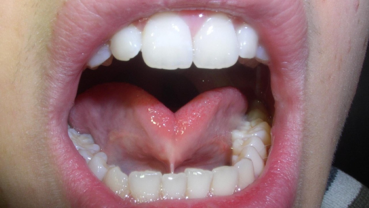 Ce înseamnă, din punct de vedere psihologic, capacitatea unei persoane de a-și îndoi limba în formă de tub sau de a-i da forma literei „U”?